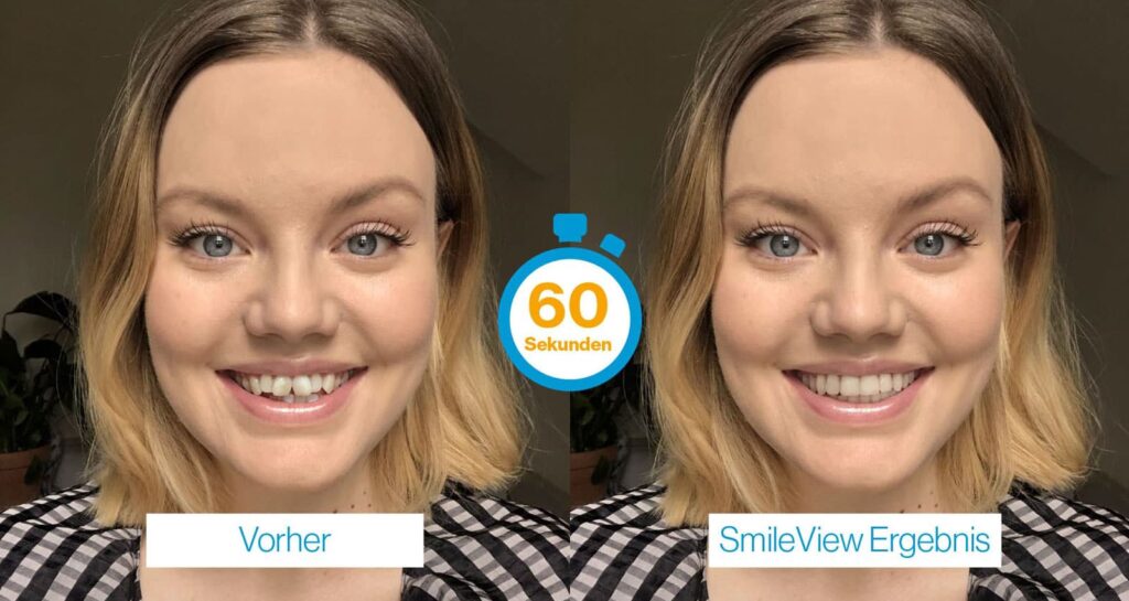 SmileView Vorher-Nachher Vergleich online testen